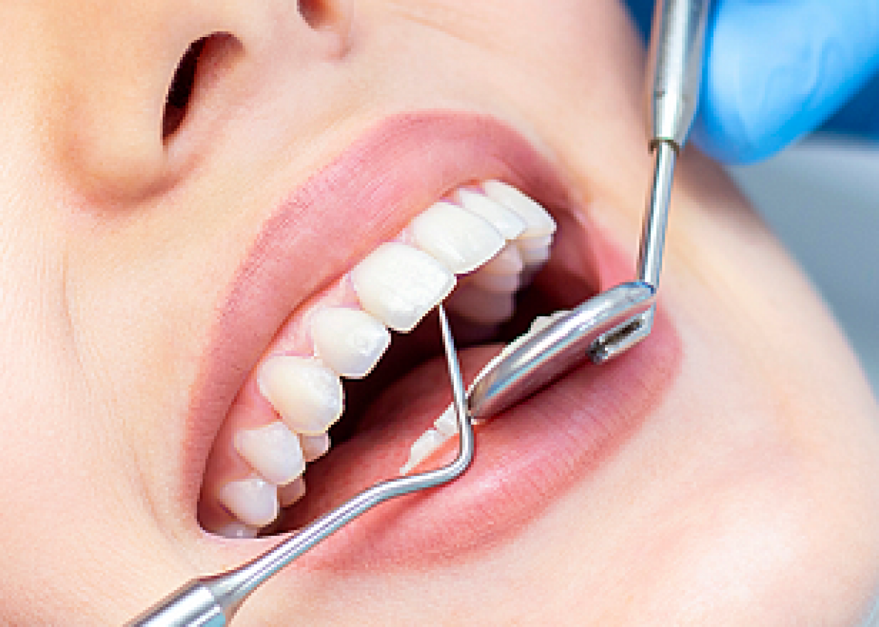 Врач лечащий кариес. Стоматология Полины Осипенко 4. Сайт стоматологии. Лечение зубов. Эстетическая стоматология.