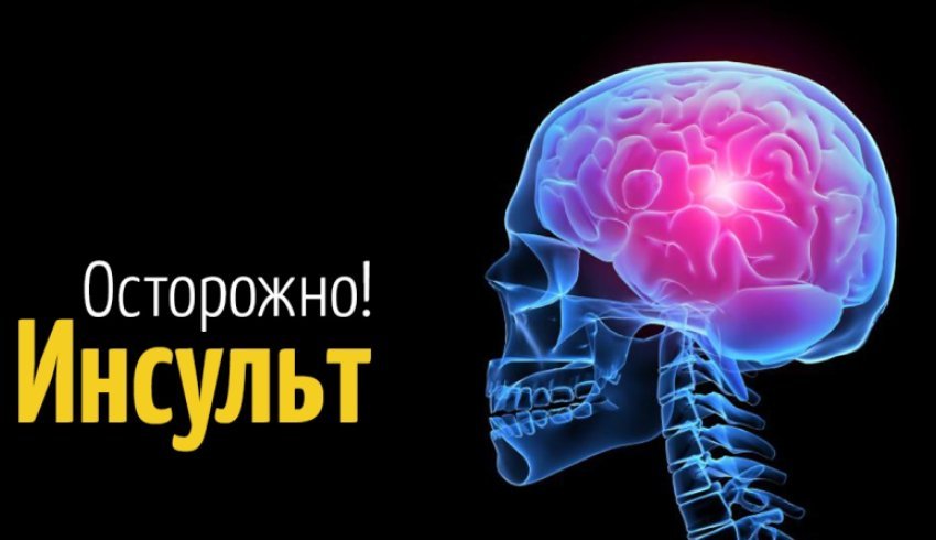 Как уберечь себя от инсульта?